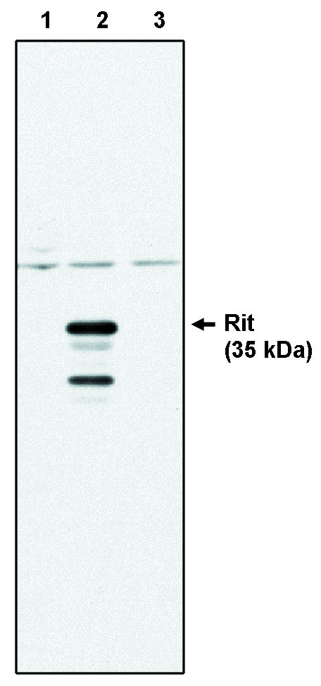 "
Western blot analysis
using Rit antibody (Cat.
No. X1185M) on control
293 cells (1), 293 cells
expressing HA-tagged Rit protein (2) and 293 cells expressing HA-tagged Rin protein (3)."